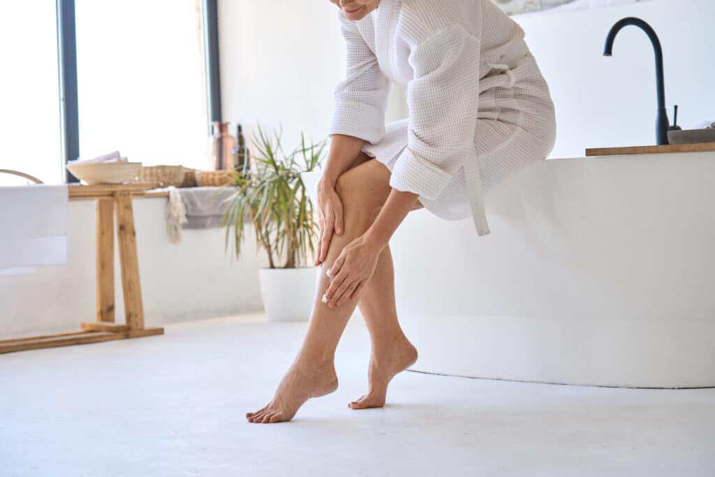 Woman holds her legs, unhappy with her spider veins, before her surface sclerotherapy appointment
