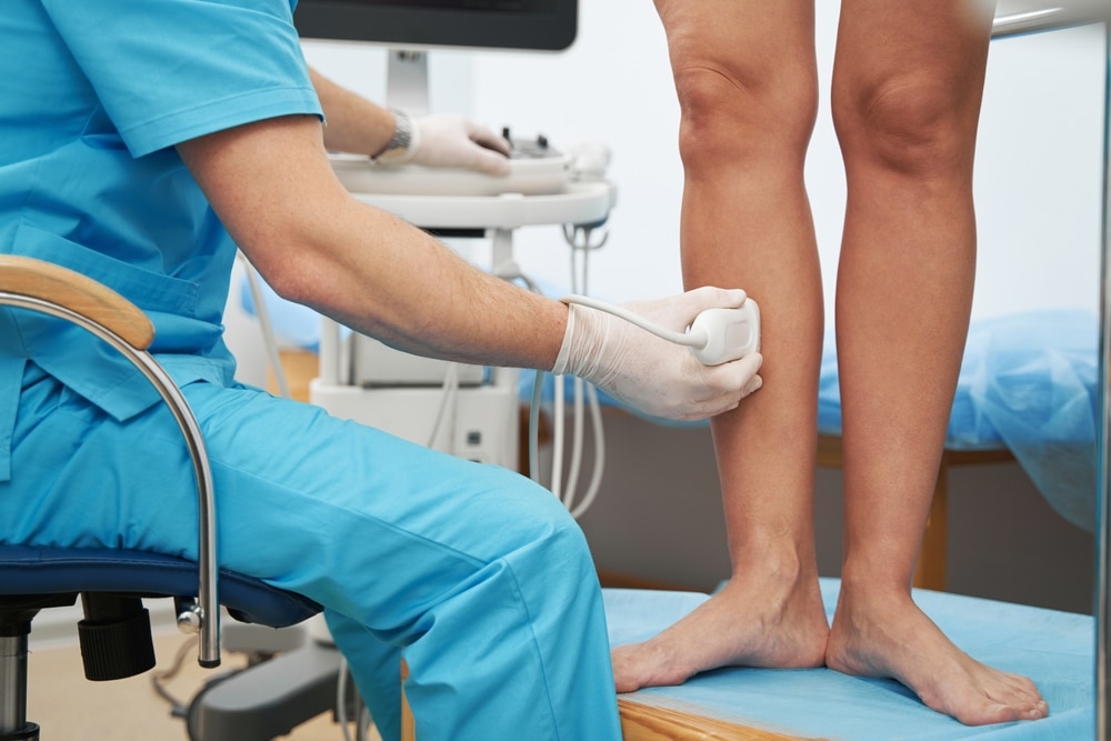 Doctor in Naperville examines a patient's legs during a vein health screening
